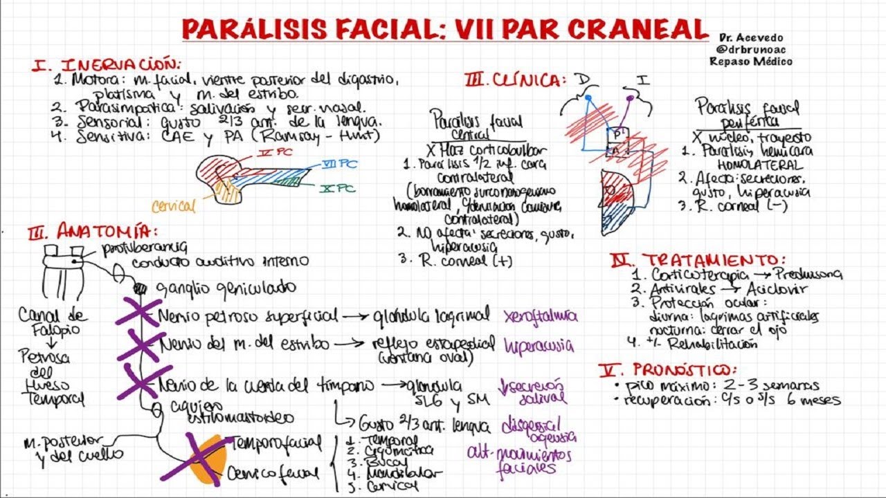 PARÁLISIS FACIAL: VII PAR CRANEAL