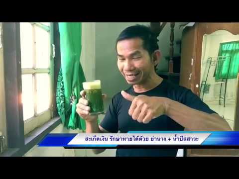 ครีมจาก neurodermatitis ค่ารักษาพยาบาลสำหรับโรคสะเก็ดเงิน