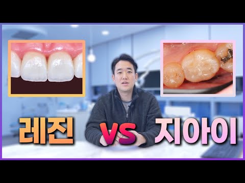 레진(비보험) vs 지아이 GI (보험) 무조건 비보험 치과재료가 좋은가? 치아 부위별로 추천 및 장단점 정리!