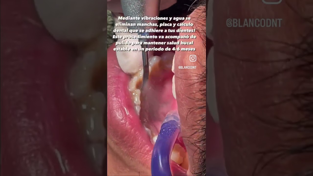 Karen Monserrat Gomez Reyes-34