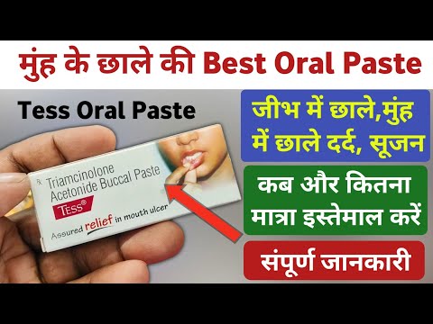 Tess paste kis kaam aata hai | Tess buccal paste uses | Tess paste benefits | Triamcinolone paste