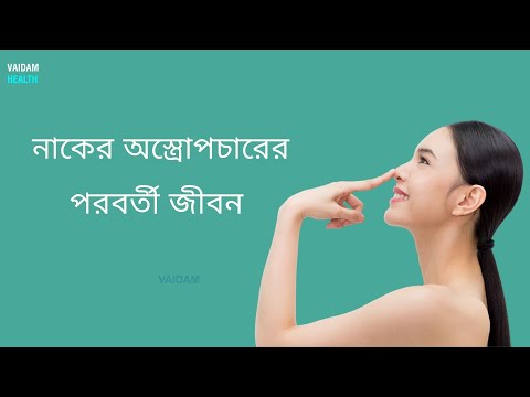 রাইনোপ্লাস্টির পরবর্তী জীবন