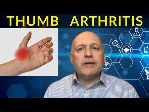Thumb Arthritis Pain : The Very Best Advice, Self Help & Treatment