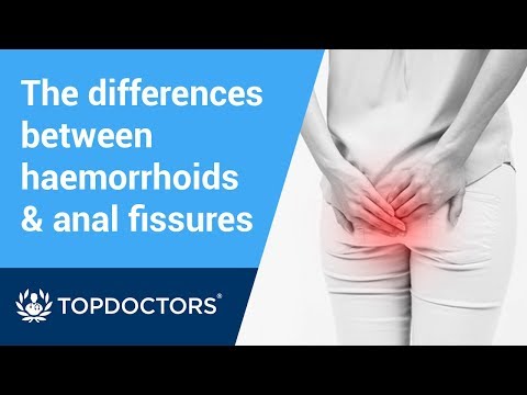 What’s the difference between haemorrhoids and anal fissures?