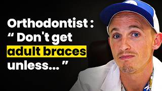 Don't get adult braces before watching this!