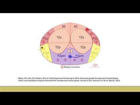 Core Videos (2020): Transperineal Prostate Biopsy Demonstration