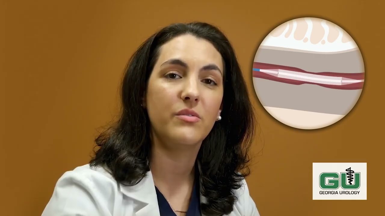 Optilume for Urethral Strictures