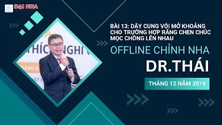 Chỉnh nha offline: Bài 13 Dây cung vói mở khoảng cho trường hợp răng chen chúc mọc chồng lên nhau