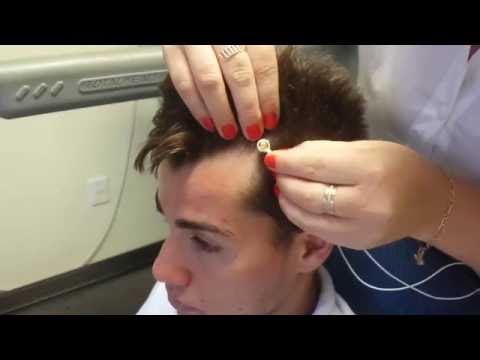 Preparação da cabeça para Eletroencefalograma ocupacional - Telemedicina Morsch