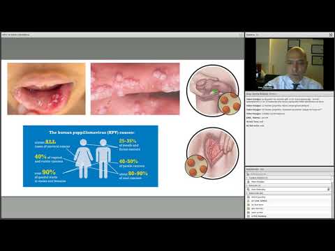 a papilloma nyelv patológiájának körvonalai