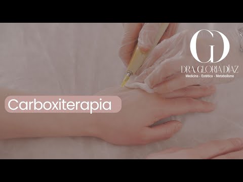 Carboxiterapia