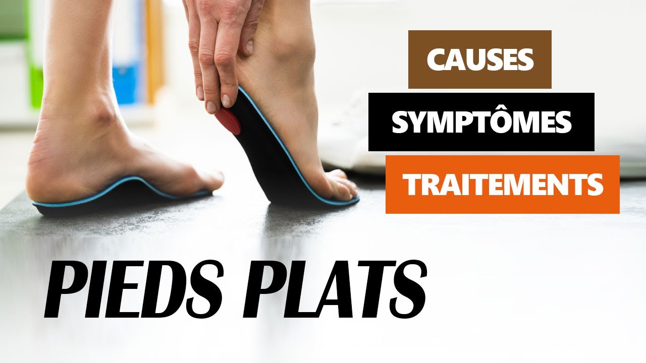Pieds plats : causes, symptômes et traitements - Index Santé