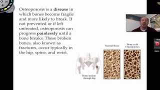 Osteoporosis
