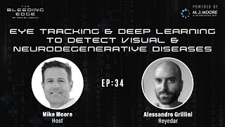 Reyedar: Eye Tracking & Deep Learning to Detect Visual & Neurodegenerative Diseases