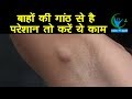 बाहों के नीचें पड़ रही है गांठ तो ऐसे क�
