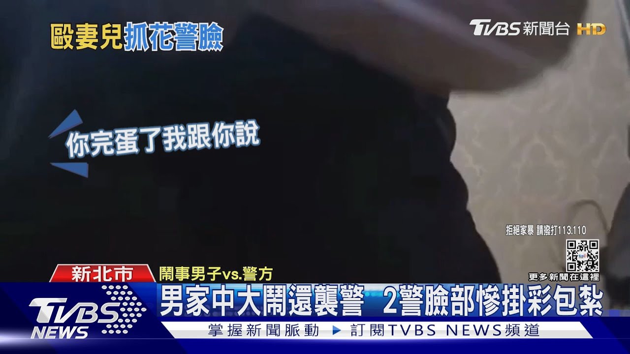 男家中大鬧還襲警 2警臉部慘掛彩包紮