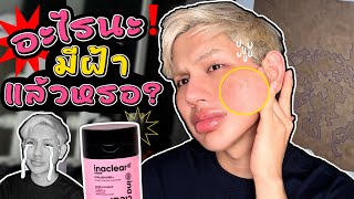 ตำนานกลับมาแล้ว ครีมฝ้าจากFrance 🇫🇷 ลดฝ้า หยุดแก่ ปึ้งกว่าเดิม!! | BOOMiiBOOM