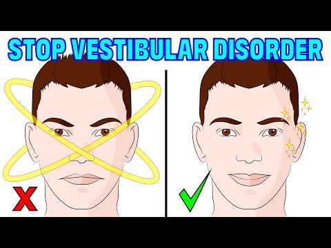 The 4 minute natural method for vestibular disorder - migraines & imbalance