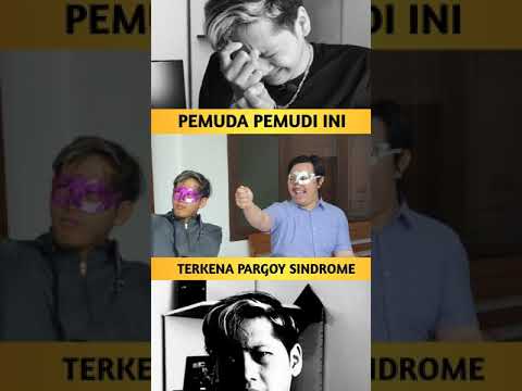 kecanduan-tiktok-kena-sindrom-pargoy
