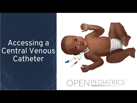 Accessing a Central Venous Catheter by M. Manning | OPENPediatrics Video