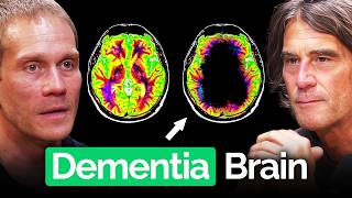 Leading Neuroscientist: At Least 45% of Dementia is Preventable With Simple Changes
