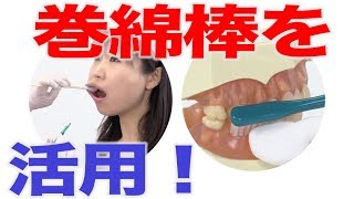 巻綿棒を活用しての口腔ケア