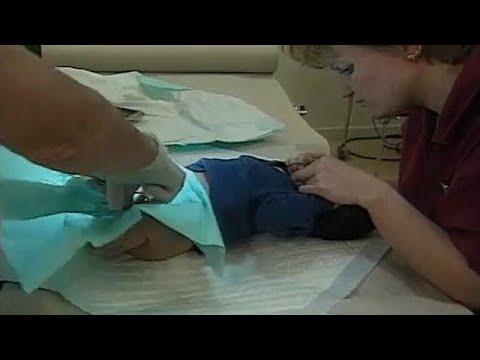 hogyan lehetne javítani a pénisz felszállóját