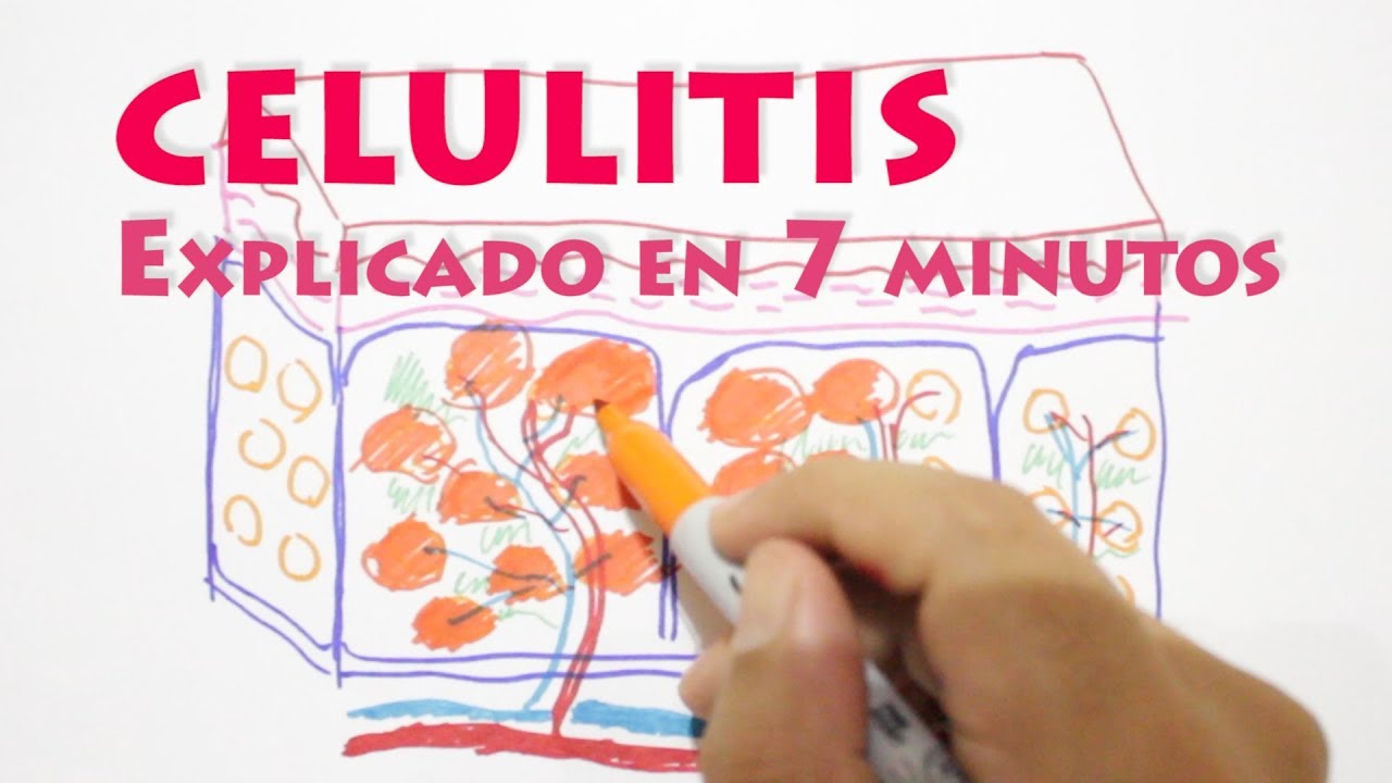 🔴Que es la CELULITIS❓ Explicado en 7 MINUTOS❗️❗️😲todo lo que no te contaron.