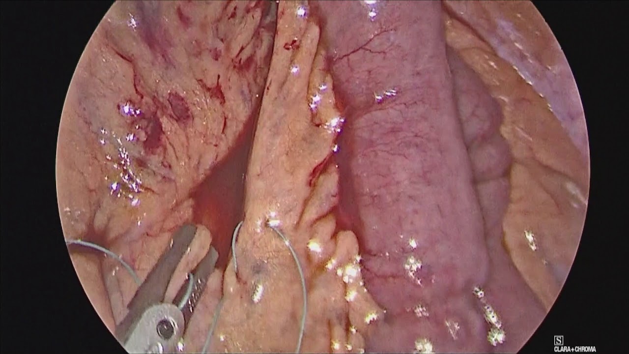 Héctor Romero Talamás-3