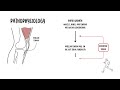 Osgood-Schlatter Disease: Teen Knee Pain Explained—Causes, Treatment & Exercises