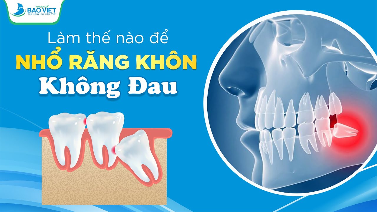 LÀM THẾ NÀO ĐỂ NHỔ RĂNG KHÔN KHÔNG ĐAU