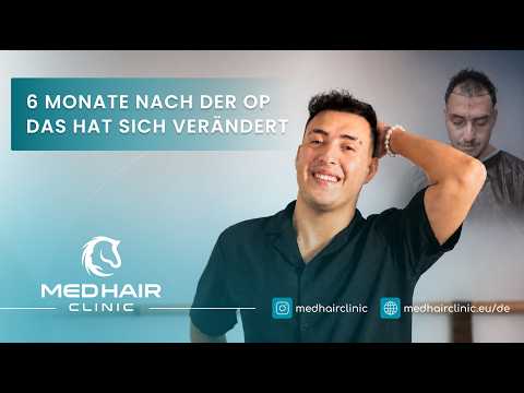 MedHair Clinic | Haartransplantationen in der Türkei Istanbul YouTube-Vdeominiatur 15