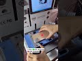 ซ่อม