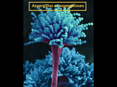 Parasitologie: L'explication  la plus facile  de l'aspargillose