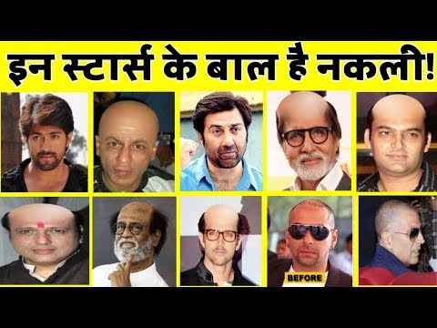 Watch lagu Images Videos Bollywood Actress Hair Transplant, Watch Images Bollywood Actress Hair Transplant free Watch, Watch Images Bollywood Actress Hair Transplant