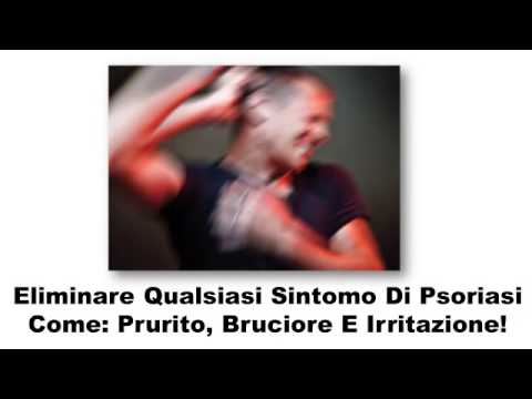 Leczema come mangiare Se è possibile uno srub a psoriasi