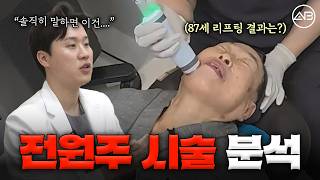 87세 전원주가 받은 피부 시술!?