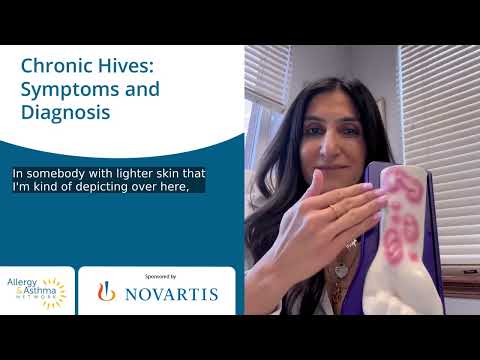 Chronic Hives: Symptoms and Diagnosis! #hives #chronichives #urticaria #chronicurticaria