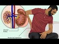 Maganin Tsakuwar Koda Kidney Infection By Abdulwahab Abubakar Gwani Bauchi ABAMagungunaAmusulunci