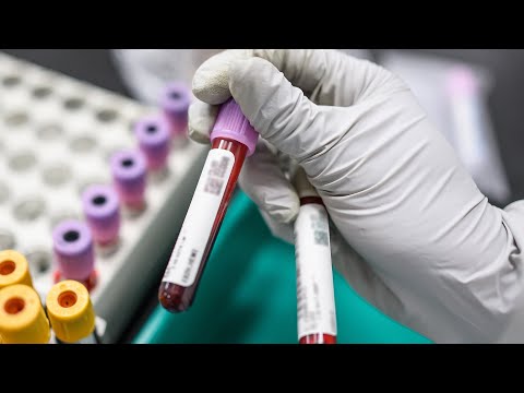 Clinical Updates on Thrombotic Thrombocytopenic Purpura (TTP)