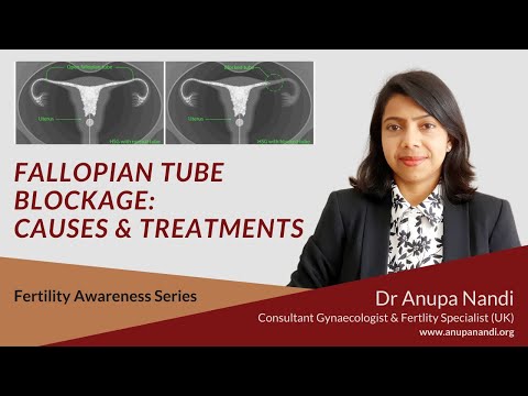 Fallopian tube blockage | Causes & Treatment | Commonly asked questions