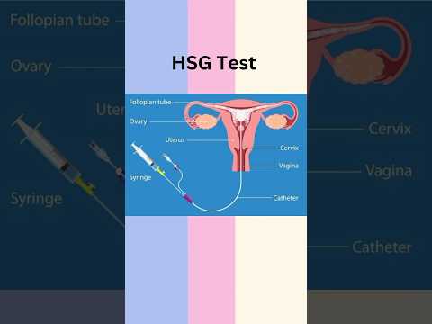 #hsgtest kya hai ? #pregnancy #health #amazing #viral #youtubeshorts