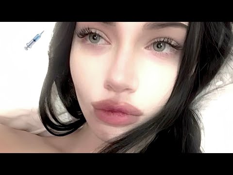 [1x MAX] 💉 horizontally wide eyes + instant eye lift (experimental)