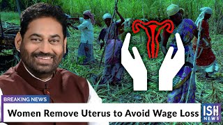 Women Remove Uterus to Avoid Wage Loss