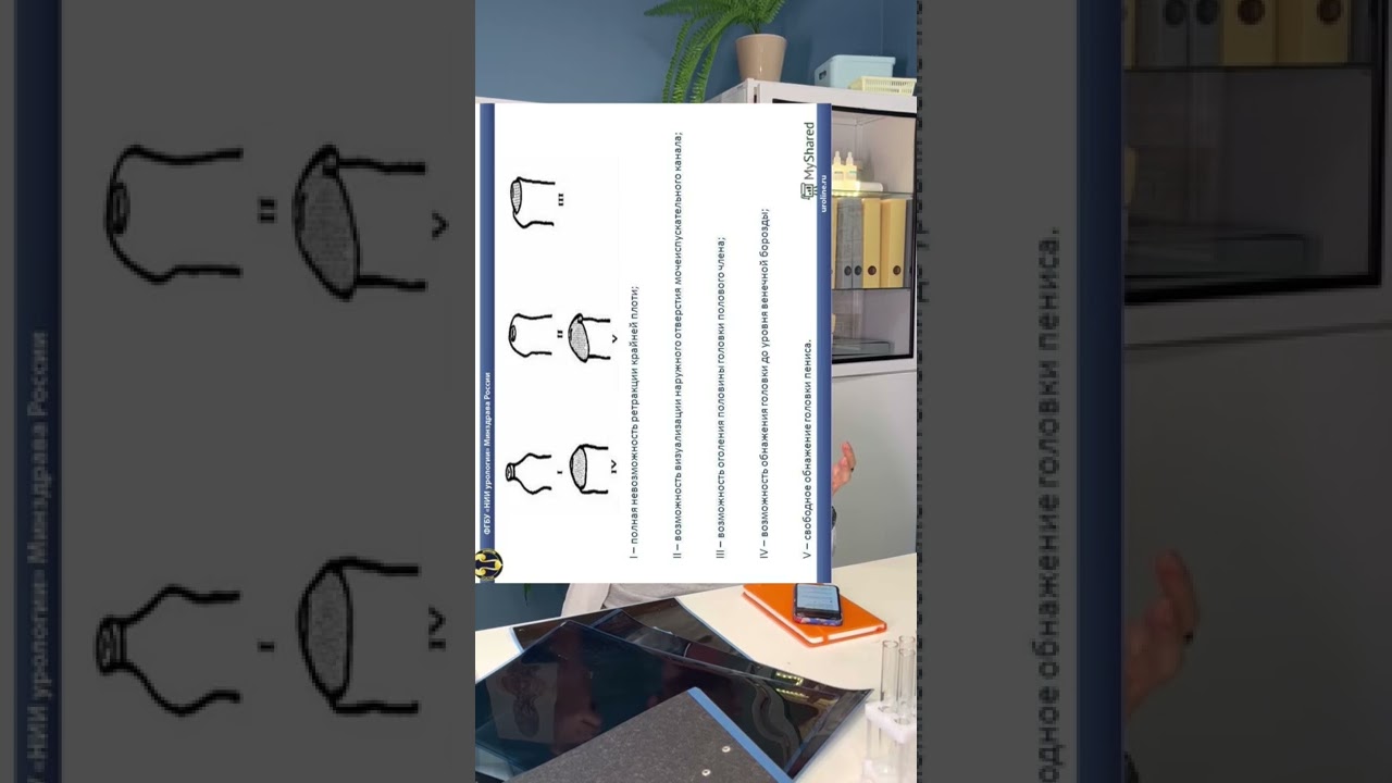 Головка не открывается, фимоз! Обрезание!😵 #vtrepal #shorts