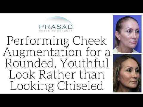 How Cheek Augmentation is Performed for a Youthful, Rounded Look, While Avoiding Looking Chiseled
