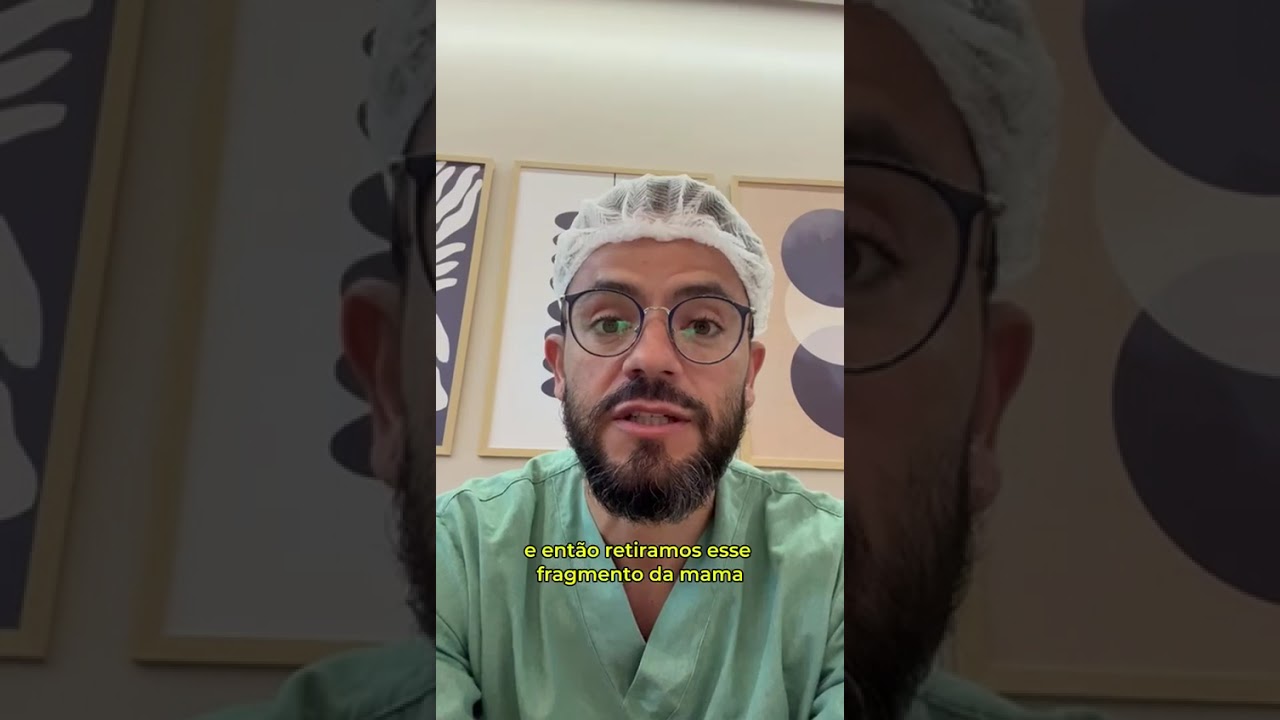 Microcalcificações de mama - carcinoma in situ. Tratamento conservador.