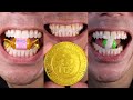 Doctor Tristan Peh Top Chocolate And Candy Chewing ASMR