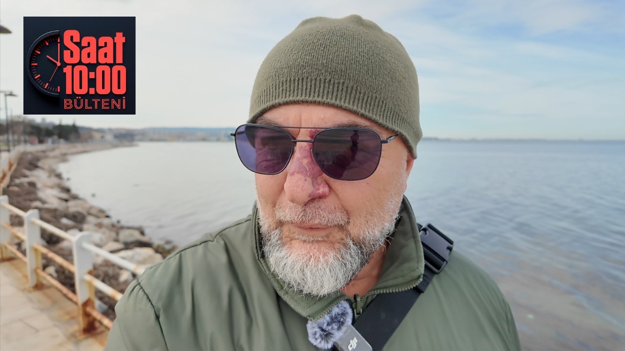 Kedi Dün Sıçrayamadı, Peki Ya Bugün?