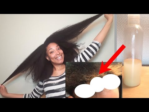 100% Natural Remedy for HAIR GROWTH | Treatment for alopecia backed by science